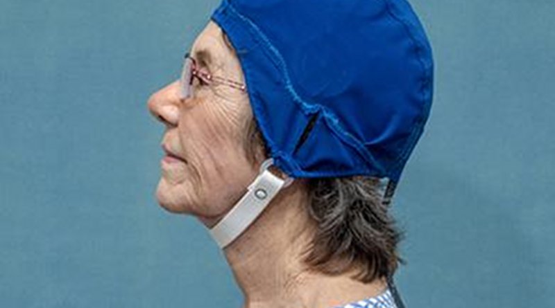 This is a patient wearing MemorEM. Credit NeuroEM Therapeutics, Inc.