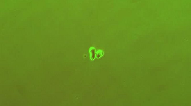 A bacterial colony genetically edited to include a gene circuit forms a purple ring as it grows. Researchers are using machine learning to discover interactions between dozens of variables that affect the ring's properties such as its thickness, how fast it forms and the number of rings that form. Credit Lingchong You, Duke University
