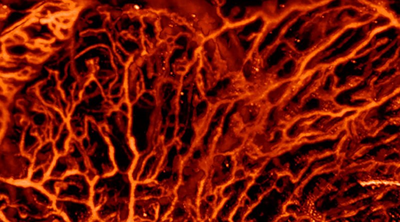Optoacoustic imaging is particularly good at visualizing blood vessels. Credit ETH Zurich / Daniel Razansky