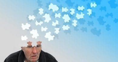 Alzheimer's dementia