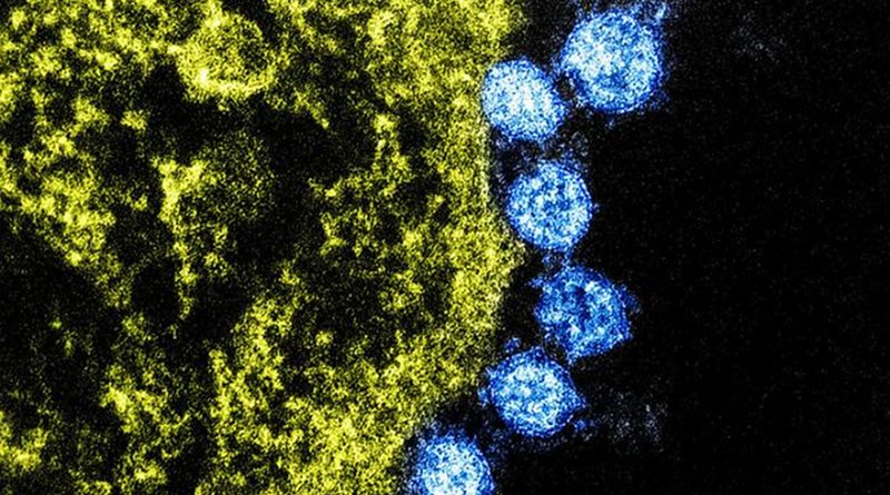 Colorized transmission electron micrograph of Middle East Respiratory Syndrome virus particles (blue) found near the periphery of an infected VERO E6 cell (yellow). Image captured and color-enhanced at the NIAID Integrated Research Facility in Fort Detrick, Maryland CREDIT NIAID