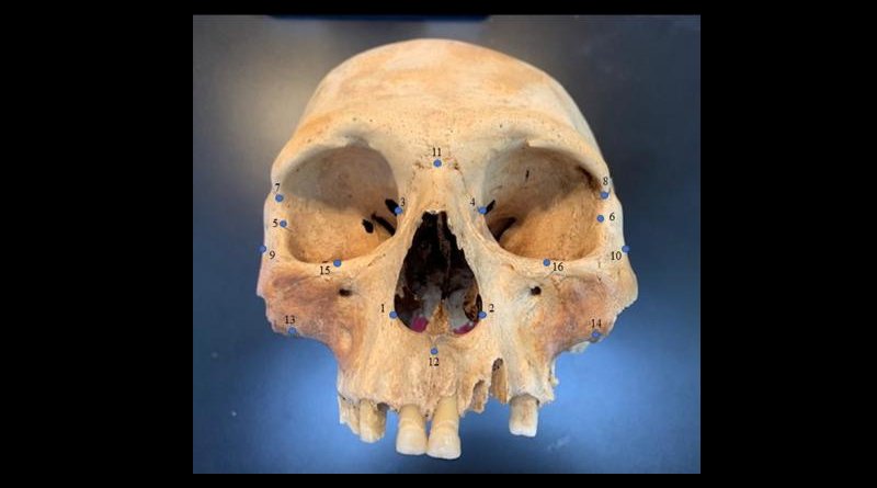 Researchers analyzed the skulls of early Caribbean inhabitants, using 3D facial "landmarks" as a genetic proxy for determining how closely people groups were related to one another. CREDIT Ann Ross/North Carolina State University