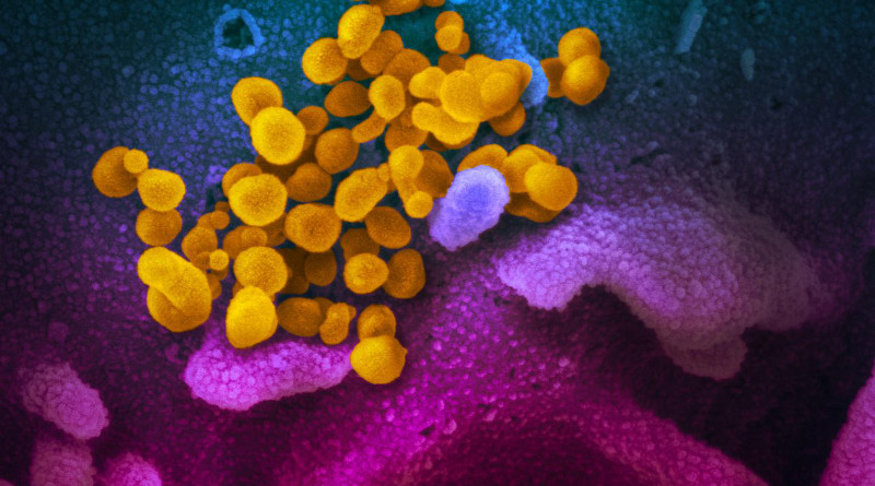 This scanning electron microscope image shows SARS-CoV-2 (yellow)--also known as 2019-nCoV, the virus that causes COVID-19--isolated from a patient in the U.S., emerging from the surface of cells (blue/pink) cultured in the lab. CREDIT NIAID RML