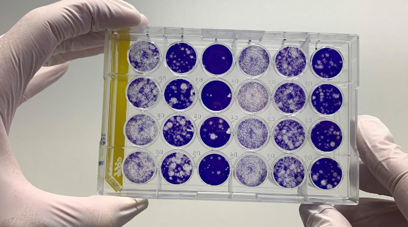 Evaluation of a 'plaque reduction neutralization test'. Using blood samples from COVID-19 patients, this test detects the antibodies which neutralize the SARS-CoV-2 virus, i.e. stop the virus infecting cells. These tests must be performed in laboratories meeting biosafety level 3 criteria, such as Charité's Institute of Virology and the Bundeswehr Institute of Microbiology. CREDIT Photo: Müller/Charité