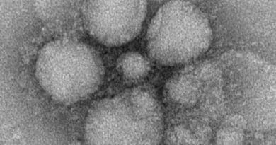 MERS-CoV particles as seen by negative stain electron microscopy. Photo Credit: Cynthia Goldsmith/Maureen Metcalfe/Azaibi Tamin, CDC