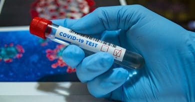 Test Covid-19 Coronavirus Quarantine Infection Pandemic