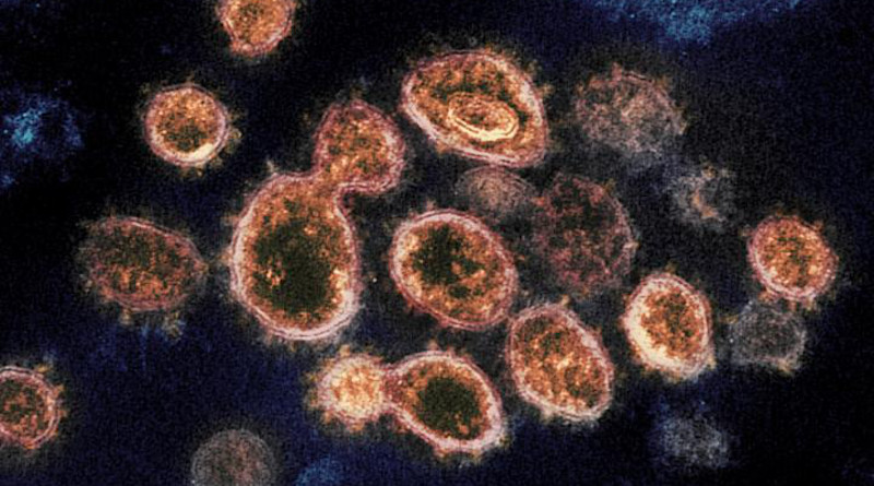 This transmission electron microscope image shows SARS-CoV-2 - the virus that causes COVID-19 - isolated from a patient in the U.S. The protrusions visible on the outside are the spike proteins that the virus particles use to fuse with and gain entry to host cells. CREDIT: NIAID