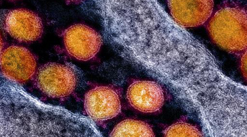 CSIC team seeks vaccine against COVID-19 using a coronavirus antigen to stimulate immunity. Photo Credit: CSIC