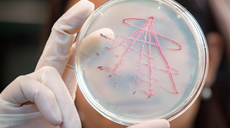 Bacterial culture - in the background: Elena Biselli, PhD Student at the TUM Department of Physics CREDIT: Andreas Heddergott / TUM