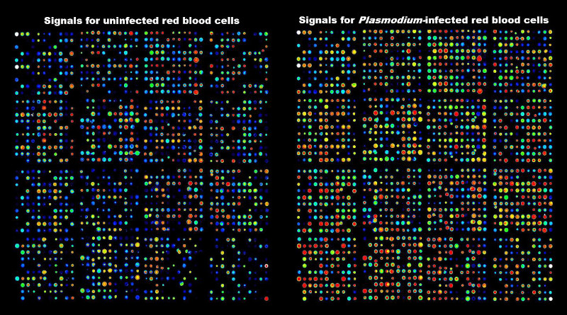 Antibody array data showing activation of kinases in human red blood cells infected with the malaria parasite. CREDIT: RMIT University
