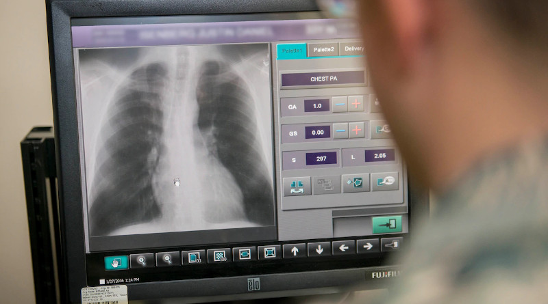 A medical technician conducts post-processing operations of a patient’s chest X-ray at Misawa Air Base, Japan, Jan. 27, 2016. Photo Credit: Air Force Staff Sgt. Benjamin W. Stratton