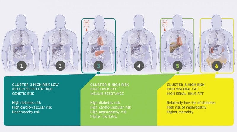 In people with prediabetes, there are six clearly distinguishable subtypes (clusters), which differ in development of the diseases, risk for diabetes, and development of complications. CREDIT IDM