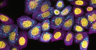 Fluorescence microscopy image of protein condensates forming inside living cells. CREDIT Weitz lab, Harvard University