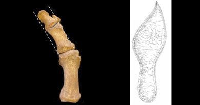 Left: Excavated medieval foot bones showing hallux valgus, with lateral deviation of the great toe. CREDIT:Jenna Dittmar. Right: Sole of adult's shoe from late 14th century Cambridge, showing pointed shape. CREDIT: Cambridge Archaeological Unit