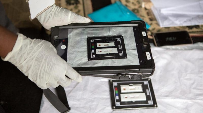 Through this work, they built a library of images of HIV tests taken in various conditions - which was used as training data for the UCL team's machine-learning algorithm. CREDIT Africa Health Research Institute