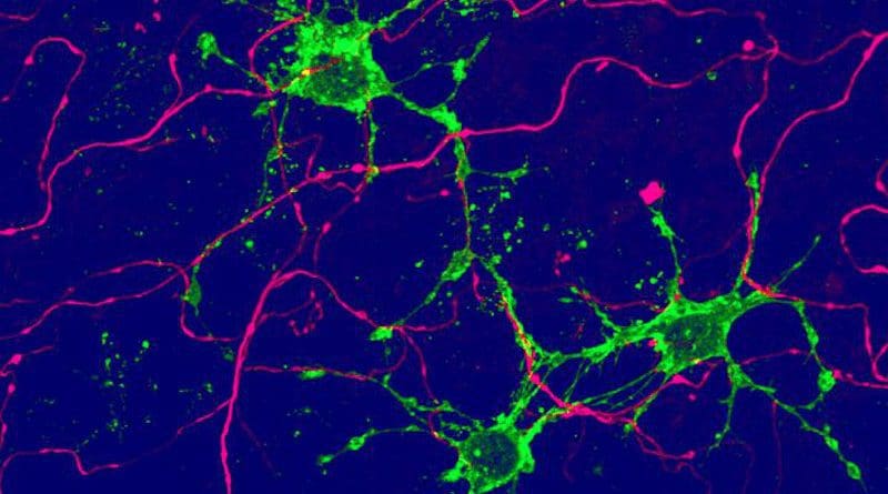 New type of glia cell (green), arising from adult stem cells in the brain, contact nerve cells (magenta). CREDIT Image: University of Basel, Biozentrum