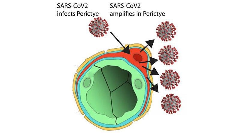 Figure depicts SARS-CoV-2 spreading through blood vessels (green) to infect pericytes (red), which amplify infection and can spread infection to other cell types in the brain. CREDIT UC San Diego Health Sciences