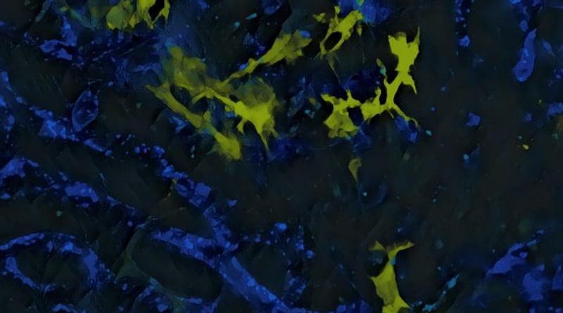 In yellow: liver macrophages, or Kupffer cells, which secrete the IL-12 protein that causes adverse effects of immunotherapy. In blue, blood vessels. CREDIT © UNIGE - Mikaël Pittet