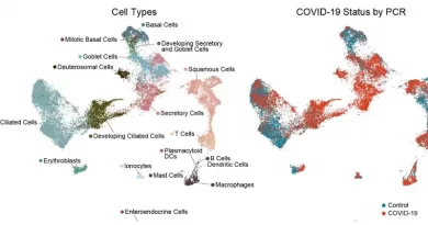 These maps represent gene expression in cells recovered from COVID-19 test swabs, based on single-cell RNA sequencing of more than 32,000 cells from 58 people. Each point in the maps represents an individual cell. At left, cell types from the nasopharynx are color-coded and arranged such that those with similar patterns of gene expression are in closer proximity. At right, red and blue colors indicate cell types that are enriched in COVID-19 (shown in red) and in healthy controls (blue). CREDIT: BioRxiv Feb 20, 2021, https://doi.org/10.1101/2021.02.20.431155