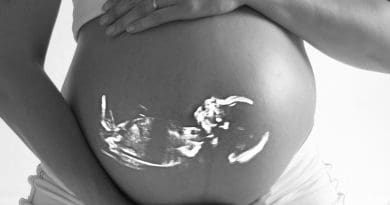 Pregnant Baby Echo Ultrasound Pregnancy Belly