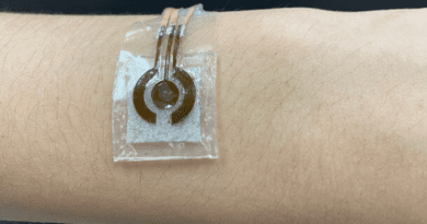 Penn State researchers developed a prototype of a wearable, noninvasive glucose sensor, shown here on the arm. CREDIT: Jia Zhu, Penn State