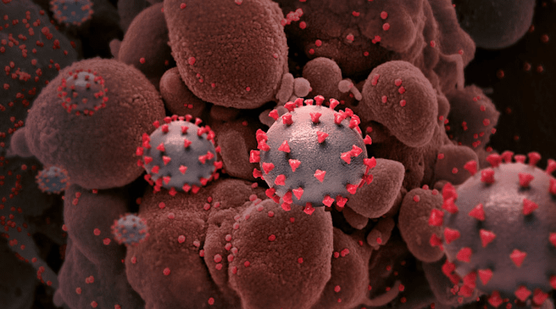 Creative rendition of SARS-COV-2 virus particles with spike proteins dotting their surfaces. Image not to scale. CREDIT: National Institute of Allergy and Infectious Diseases, NIH
