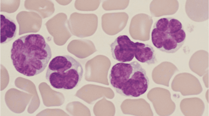 Virus-induced leukaemia cells CREDIT: Dr Uchiyama
