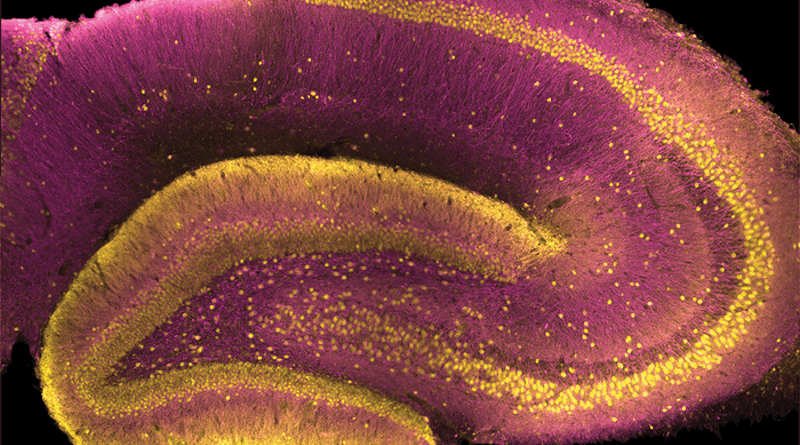 The dentate gyrus appears as a thick, mostly yellow, C-shaped body at center-left of this cross-section of a rat hippocampus. CREDIT: USC Dornsife/Yuni Kay