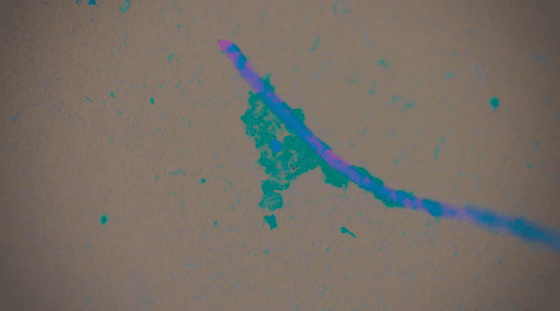 A. piece of microplastic fiber is shown under a microscope with biofilm (fuzzy blue) and T. gondii (blue dot) and giardia (green dot) pathogens. CREDIT: Karen Shapiro, UC Davis