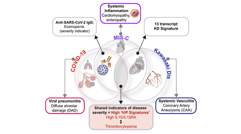UC San Diego researchers summarize the similarities and differences between COVID-19, MIS-C and Kawasaki disease, three conditions unified by the same immune-associated gene signature. CREDIT: UC San Diego Health Sciences