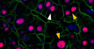 Human liver is composed of cells with different amounts of DNA. Most of the cells have just two copies of DNA, as the cell indicated with a white arrow. Some cells accumulate more sets of DNA, like the ones indicated with yellow arrows. Those various types of cells renew differently. CREDIT: Paula Heinke