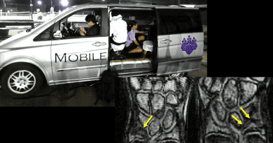 A portable MRI system. Photo Credit: University of Tsukuba