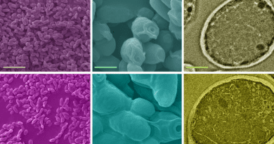 In this image, A control group of yeast cells (top row) is compared to yeast cells after they have accumulated lead from contaminated water (bottom row). Scanning electron microscope (SEM) images show, at left, an overview, and at center, a closer look at the yeast cells, and at right transmission electron microscope (TEM) images show an individual yeast cell. CREDIT: Image courtesy of Patritsia Statathou, Neil Gershenfeld, et. al