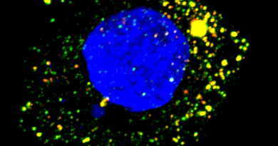 Fluorescence microscopy image of HAV-infected cultured human liver cell. viral RNA targeted by ZCCHC14 appears green, and the virus’s protein red. CREDIT: Maryna Kapustina, UNC School of Medicine