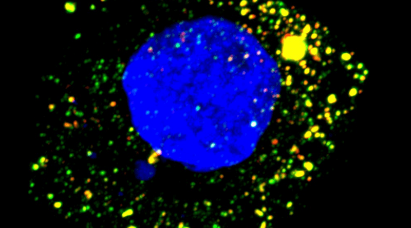 Fluorescence microscopy image of HAV-infected cultured human liver cell. viral RNA targeted by ZCCHC14 appears green, and the virus’s protein red. CREDIT: Maryna Kapustina, UNC School of Medicine