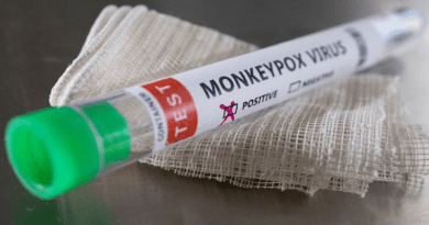 Monkeypox virus test (photo supplied)