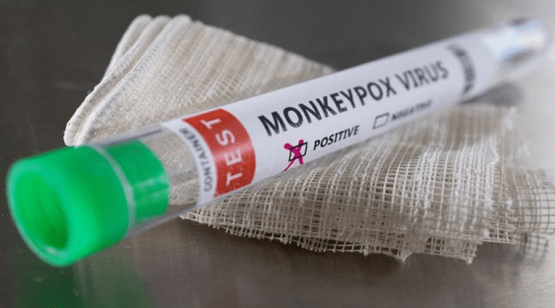 Monkeypox virus test (photo supplied)