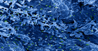 Colorized scanning electron micrograph of monkeypox virus (green) on the surface of infected VERO E6 cells (blue). Image captured at the NIAID Integrated Research Facility (IRF) in Fort Detrick, Maryland. CREDIT: NIAID