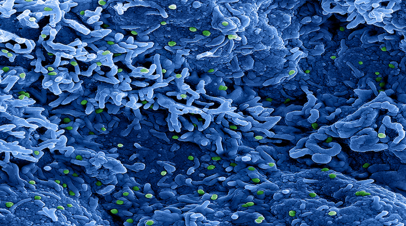 Colorized scanning electron micrograph of monkeypox virus (green) on the surface of infected VERO E6 cells (blue). Image captured at the NIAID Integrated Research Facility (IRF) in Fort Detrick, Maryland. CREDIT: NIAID