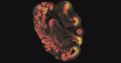 A brain organoid about 3 millimeters in size made from stem cells of a chimpanzee. The brain stem cells are stained red; brain stem cells that received the ARHGAP11B gene are shown in green. Photo: Jan Fischer