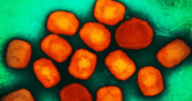 Colorized transmission electron micrograph of monkeypox virus particles (orange) cultivated and purified from cell culture. Image captured at the NIAID Integrated Research Facility (IRF) in Fort Detrick, Maryland. CREDIT: NIAID