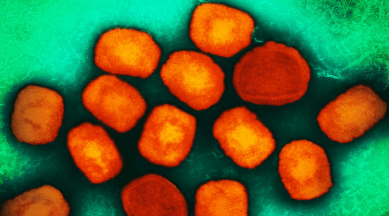 Colorized transmission electron micrograph of monkeypox virus particles (orange) cultivated and purified from cell culture. Image captured at the NIAID Integrated Research Facility (IRF) in Fort Detrick, Maryland. CREDIT: NIAID