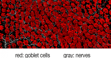 Harvard Medical School researchers have analyzed the molecular crosstalk between pain fibers in the gut and goblet cells that line the walls of the intestine. The work shows that chemical signals from pain neurons induce goblet cells to release protective mucus that coats the gut and shields it from damage. The findings show that intestinal pain is not a mere detection-and-signaling system, but plays a direct protective role in the gut. CREDIT: Chiu Lab/Harvard Medical School
