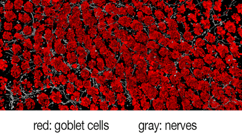 Harvard Medical School researchers have analyzed the molecular crosstalk between pain fibers in the gut and goblet cells that line the walls of the intestine. The work shows that chemical signals from pain neurons induce goblet cells to release protective mucus that coats the gut and shields it from damage. The findings show that intestinal pain is not a mere detection-and-signaling system, but plays a direct protective role in the gut. CREDIT: Chiu Lab/Harvard Medical School