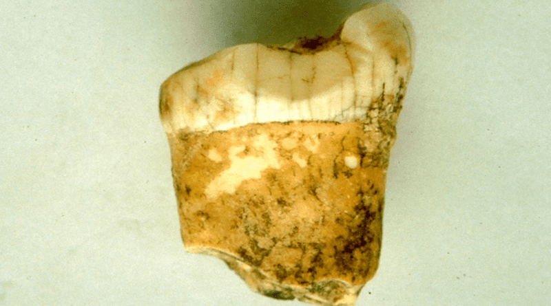A first molar from a Neanderthal, analysed for this study. CREDIT: © Lourdes Montes