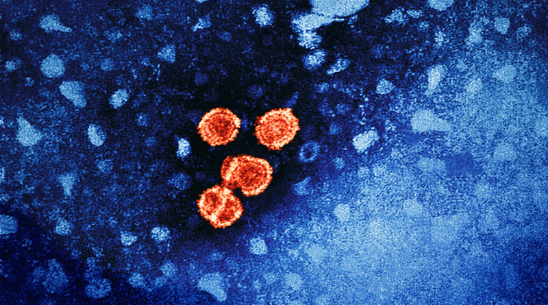 Hepatitis B virus particles (red) CREDIT: CDC/NIAID