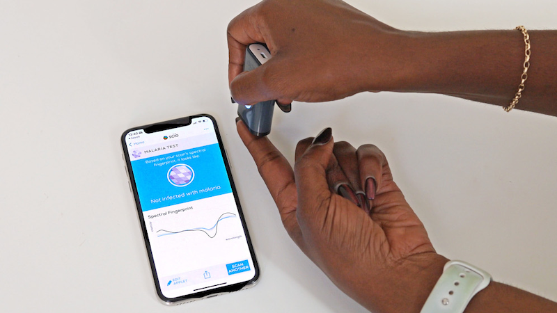 A smartphone-operated spectrometer has been developed to detect changes in blood caused by malaria. Copyright: University of Queensland. This image has been cropped.