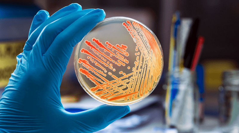 Gram Negative Bacteria CREDIT: Adobe Stock