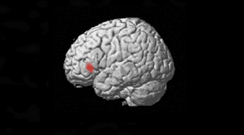 Scientists show that in the inferior frontal gyrus, neural activity differs in response to food images, depending on whether those images are presented consciously or unconsciously. This difference was associated with scores on eating behaviors such as emotional eating and restrained eating. CREDIT: Osaka Metropolitan University