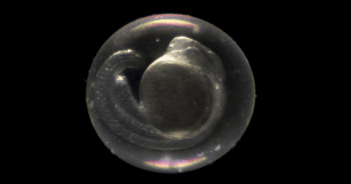 Zebrafish embryo CREDIT: UC Santa Barbara